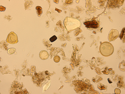 Grains de pollen grossis au microscope