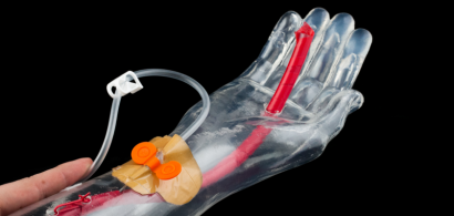 Dispositif médical (bras) conçu à l'ISIFC