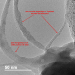 Vue de nanotubes de carbones recouverts de TRAIL au microscope.