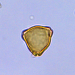vue_microscopique_dun_pollen_de_noisetier