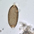 Photo de parasite au microscope